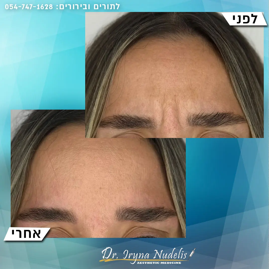תמונת לפני ואחרי, בין הגבות, תוצאה 4