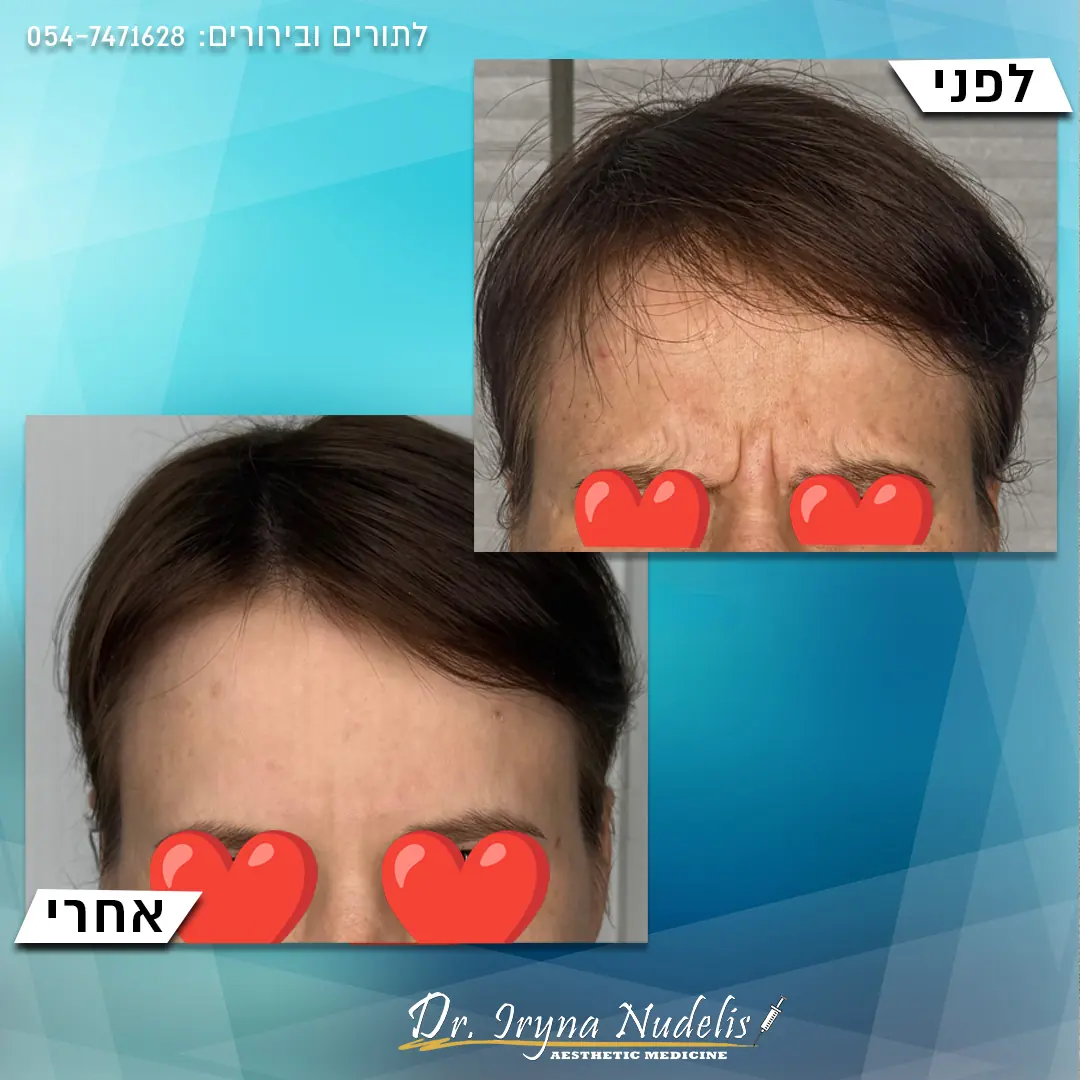 תמונת לפני ואחרי, בין הגבות, תוצאה 5