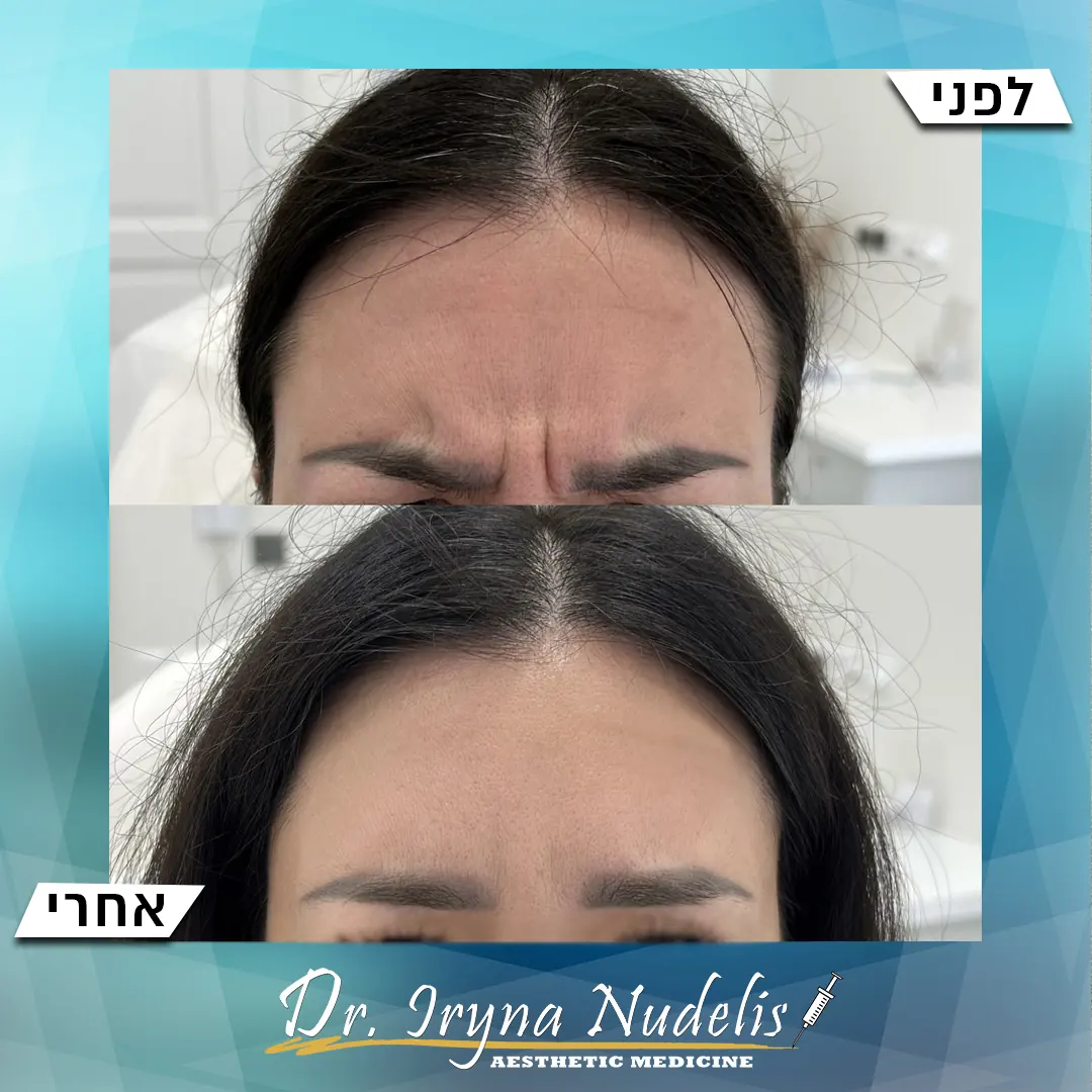 תמונת לפני ואחרי, בין הגבות, תוצאה 7