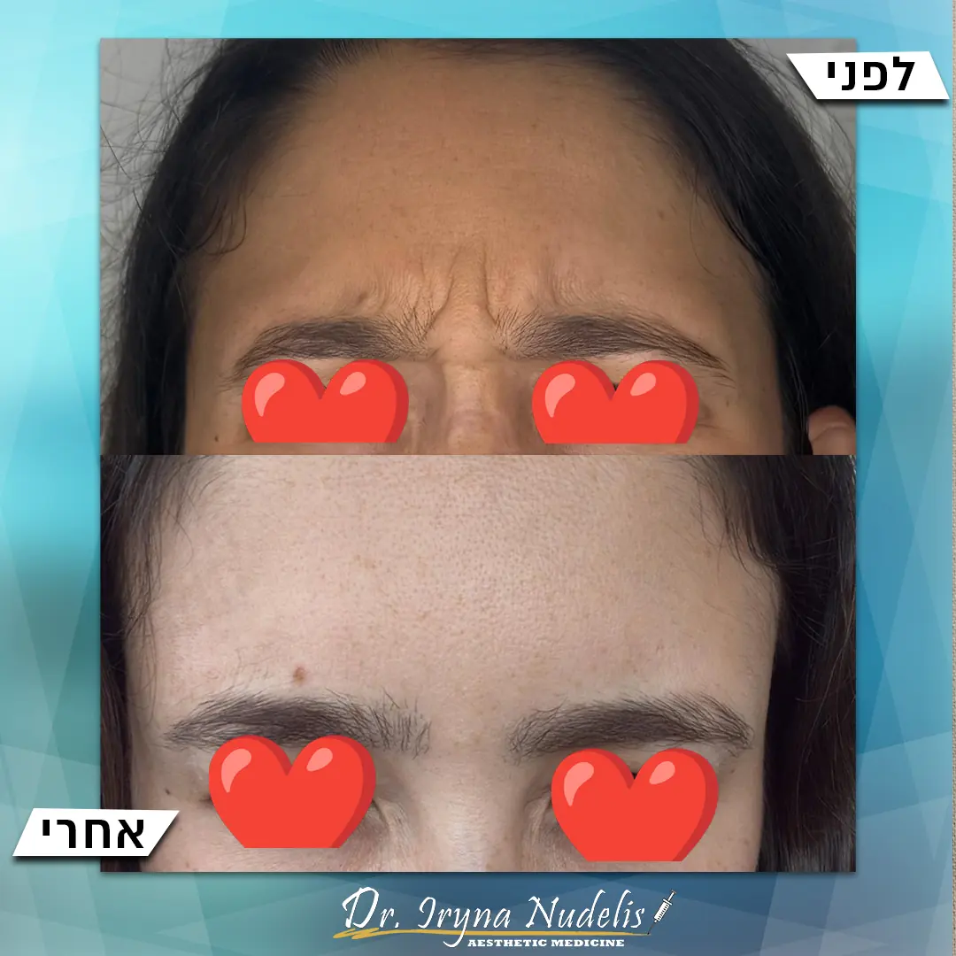 תמונת לפני ואחרי, בין הגבות, תוצאה 8